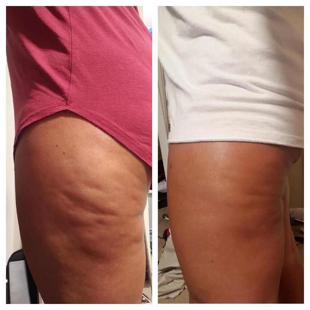 Anti cellulite Massage Oil
